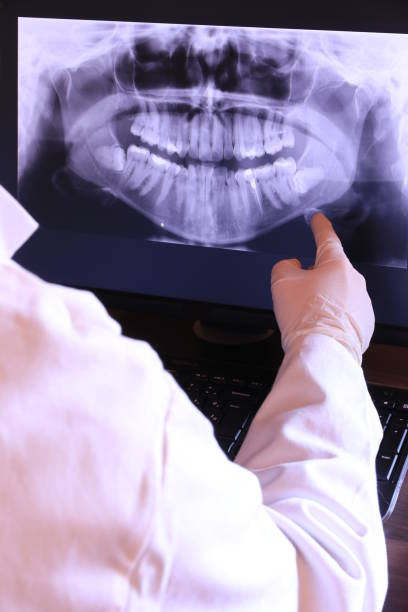 Emergency Dental Filling Replacement in CO