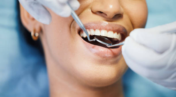 Best Broken Tooth Emergency  in Aristocrat Ranchettes, CO